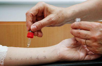 Why go to an allergist for diagnosis and treatment?